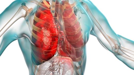 علامات الالتهاب الرئوي تعرف عليها لتجنب الاصابة